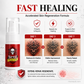 💪50% OFF | Tattoo Aftercare Moisturizing Spray 💧 Hydrating Mist for Vibrant & Healthy Ink